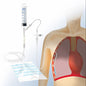 Pleural and Thoracic Drainage Set—Complete Set According to Matthys