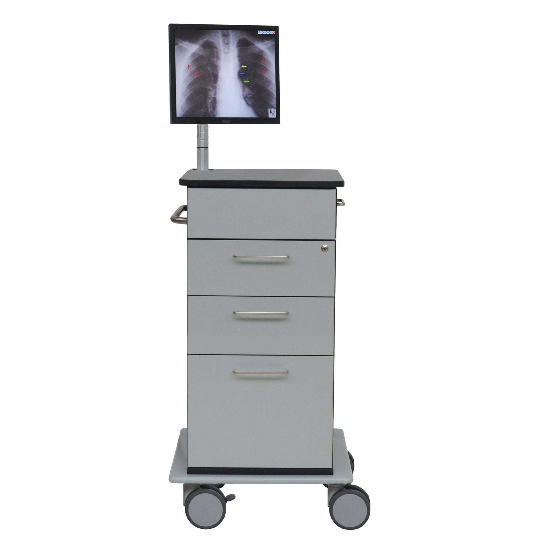 Pictured is a Novocal computer cart Model I | Package (1 piece) with a right pull-out keyboard tray and mouse compartment. It has three drawers, four wheels, metal handles, and a monitor on the top displaying a chest X-ray.